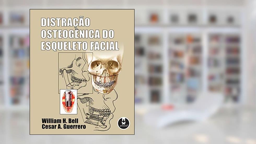 Distração Osteogênica do Esqueleto Facial, do autor William H. Bell; Cesar A. Guerrero