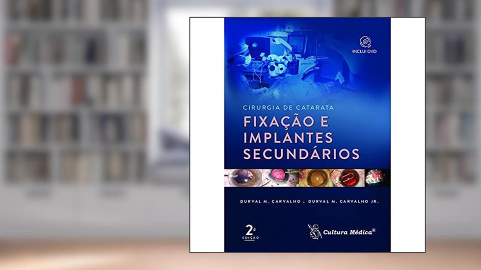 Cirurgia de Catarata: Fixação e Implantes Secundários, do autor Durval M. Carvalho; Durval M. Carvalho Jr.