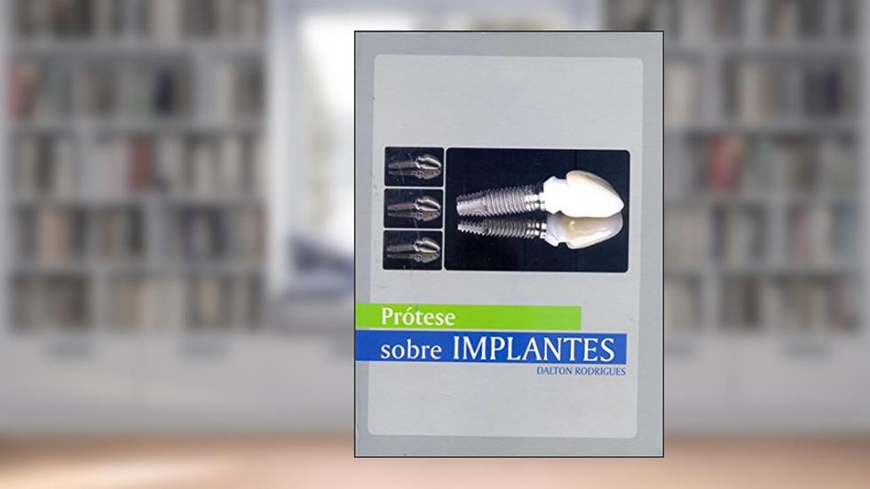 Prótese Sobre Implantes, do autor Dalton Rodrigues