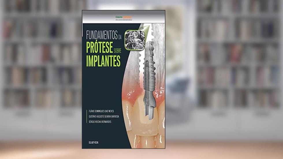 Fundamentos da prótese sobre implantes, do autor Gustavo Barbosa
