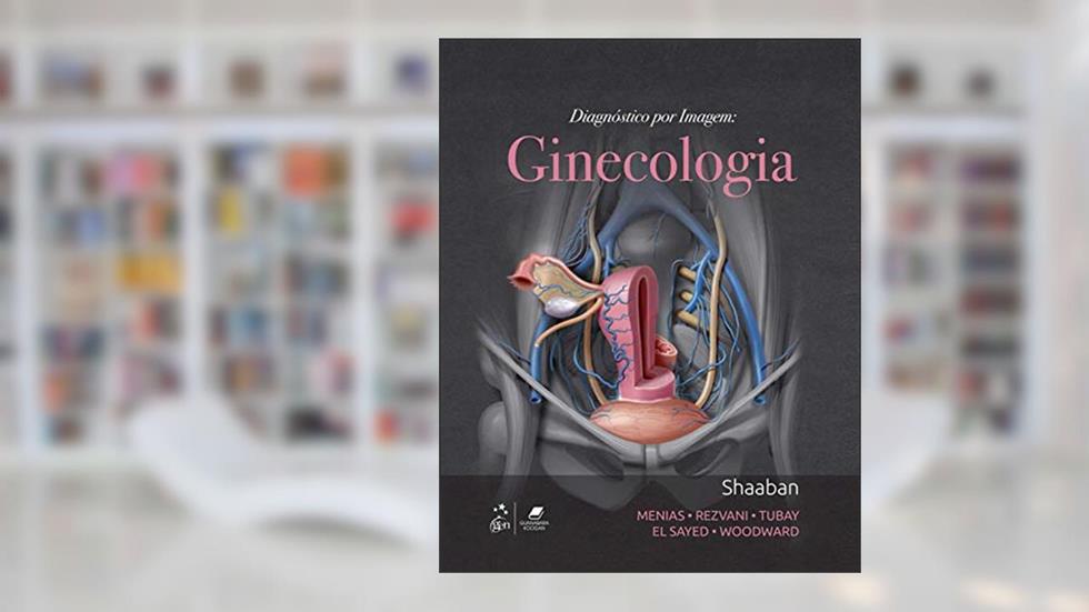 Diagnóstico por Imagem: Ginecologia, do autor Akram Akram M Shaaban