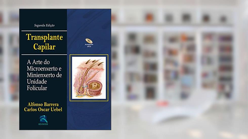 Transplante Capilar: A Arte do Microenxerto, do autor Alfonso Barrera; Carlos Oscar Uebel