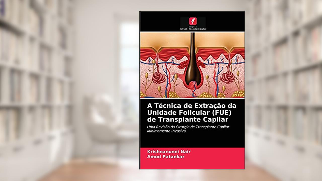 A Técnica de Extração da Unidade Folicular (FUE) de Transplante Capilar: Uma Revisão da Cirurgia de Transplante Capilar Minimamente Invasiva, do autor Krishnanunni Nair; Amod Patankar