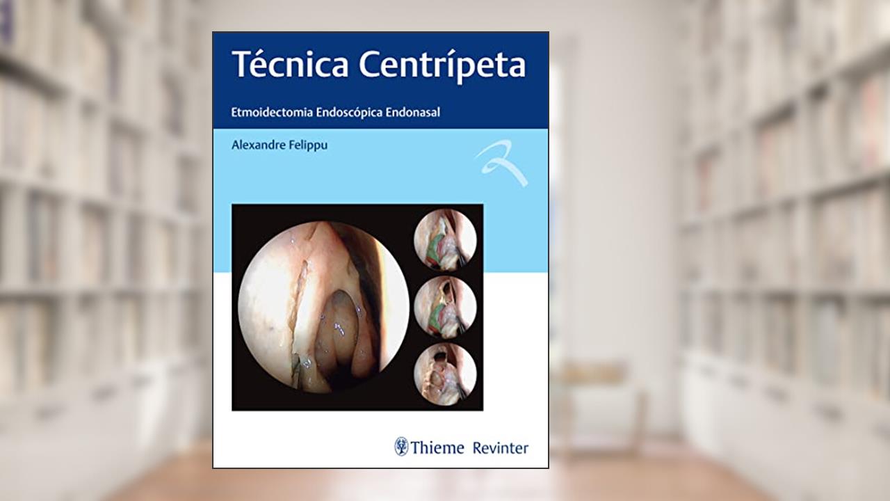 Técnica Centrípeta: Etmoidectomia Endoscópica Endonasal, do autor Alexandre Felippu