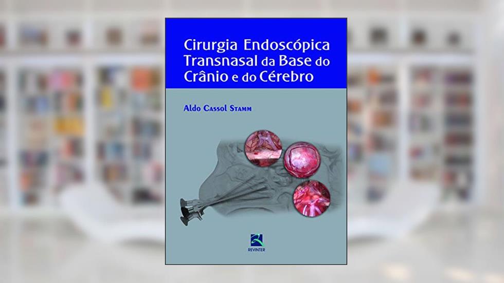 Cirurgia Endoscópica Transnasal da Base do Crânio, do autor Aldo Cassol Stamm
