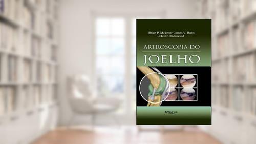 Capa de Artroscopia Do Joelho, do autor Richmond John C.^Bono James V.^Mckeon Brian P.