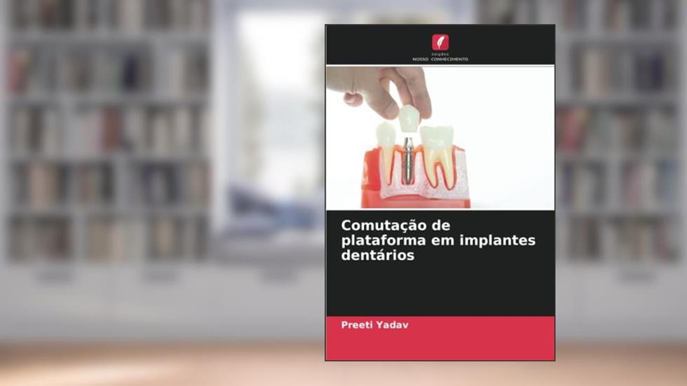 Comutação de plataforma em implantes dentários, do autor Preeti Yadav