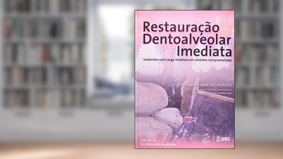 Restauração Dentoalveolar Imediata - Implantes com Carga Imediata em Alvéolos Comprometidos, do autor José Carlos Martins da Rosa