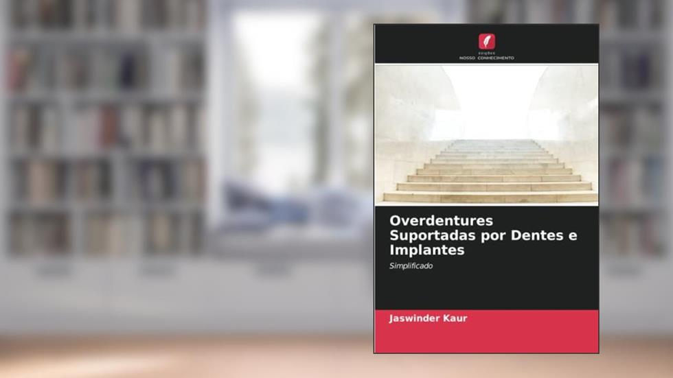 Overdentures Suportadas por Dentes e Implantes: Simplificado, do autor Jaswinder Kaur