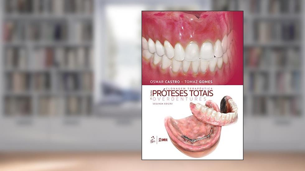 Clonagem Terapêutica para Próteses Totais e Overdentures, do autor Osmar Castro; Tomaz Gomes