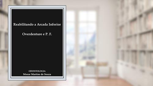 Capa de Reabilitando a Arcada Inferior Overdenture e Prótese Fixa: Prótese Odontológica, do autor Mozar Martins