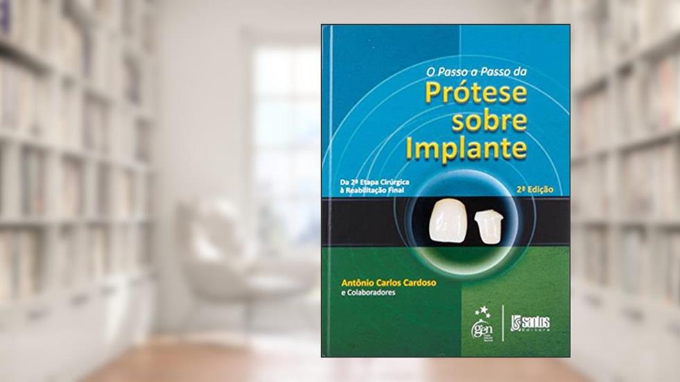 O Passo-a-Passo da Prótese Sobre Implantes - Da 2ª Etapa Cirúrgica à Reabilitação Final, do autor Antonio Carlos Cardoso