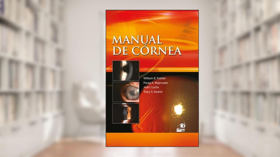 Manual de Córnea, do autor Willian Tratller