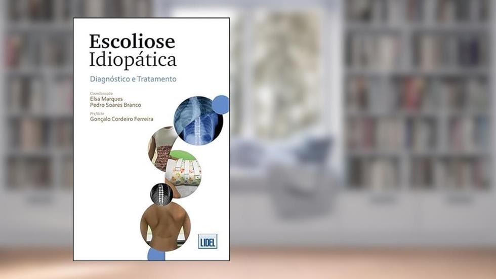 Escoliose Idiopática - Diagnóstico e Tratamento, do autor Elsa Marques; pedro Soares Branco