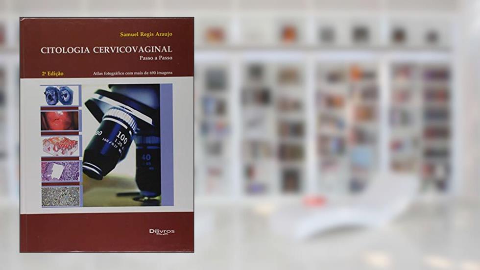 Citologia Cervicovaginal - Passo A Passo, do autor Samuel Regis Araujo