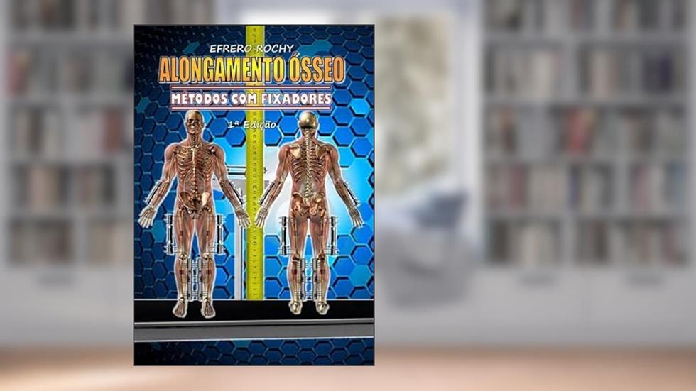 Alongamento Osseo - Metodos com Fixadores, do autor Efrero Reochy