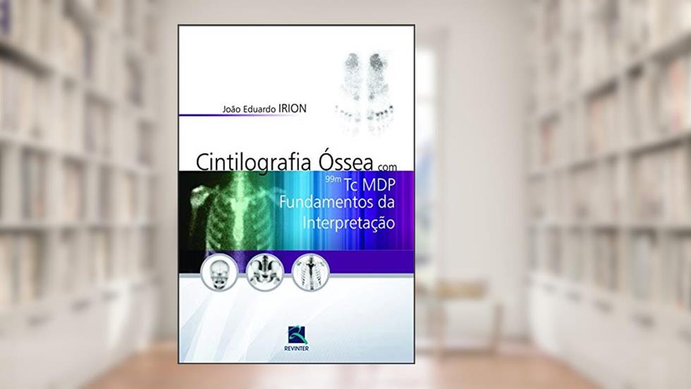 Cintilografia Óssea com 99M Tc MDP: Fundamentos da Interpretação, do autor João Eduardo Irion