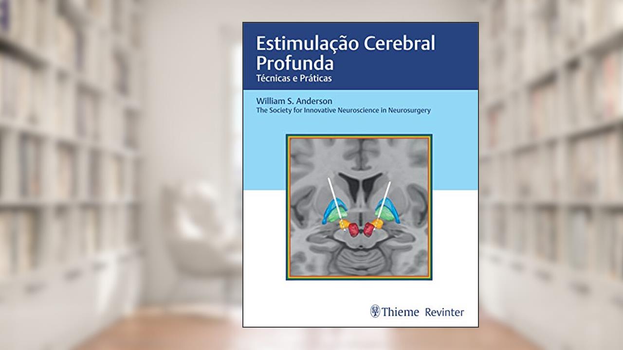 Estimulação Cerebral Profunda: Técnicas e Práticas, do autor Anderson William S.