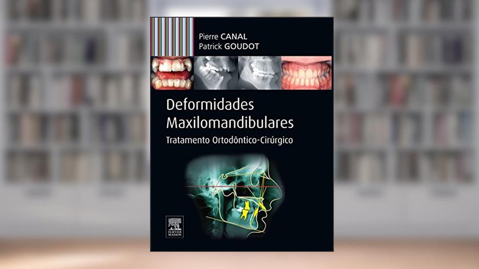 Deformidades maxilo-mandibulares: Tratamento Ortodôntico-cirúrgico, do autor Pierre Canal