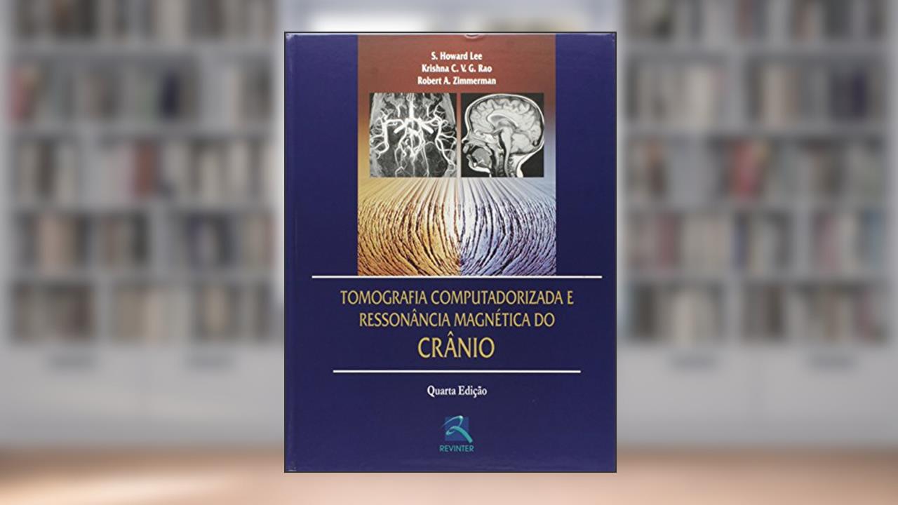 Tomografia Computadorizada e Ressonância Magnética do Crânio, do autor S. Howard Lee; Krishna C. V. G. Rao; Robert A. Zimmerman