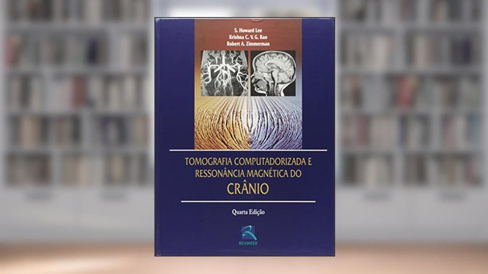 Tomografia Computadorizada e Ressonância Magnética do Crânio, do autor S. Howard Lee; Krishna C. V. G. Rao; Robert A. Zimmerman