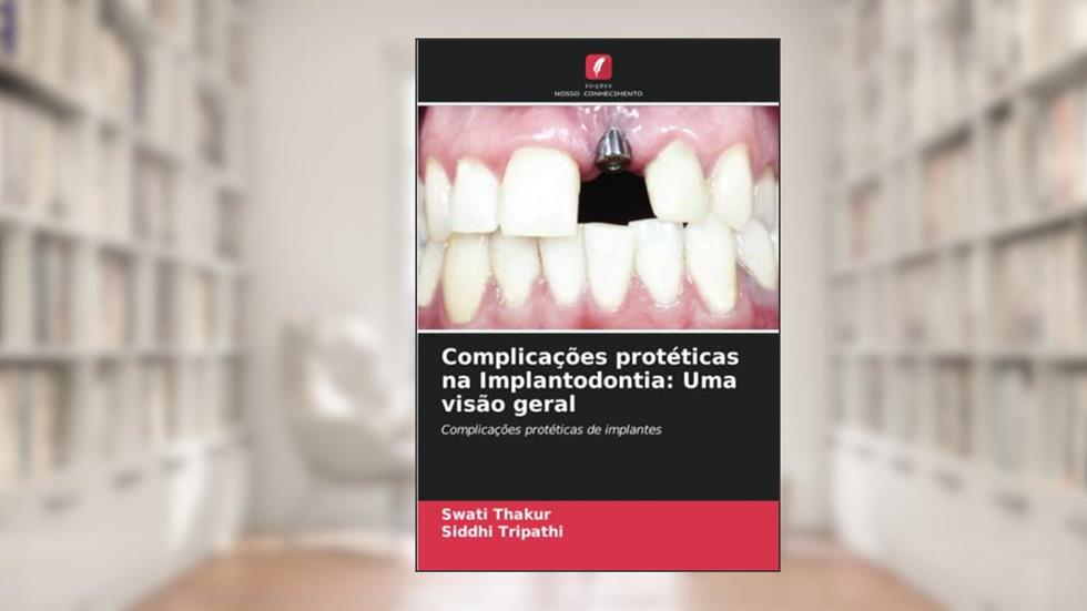 Complicações protéticas na Implantodontia: Uma visão geral: Complicações protéticas de implantes, do autor Swati Thakur; Siddhi Tripathi