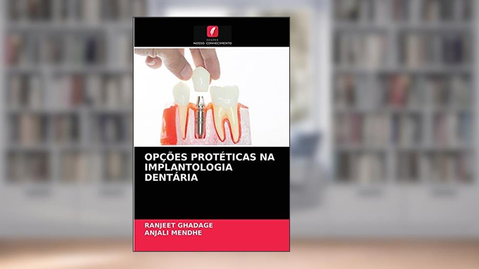 OPÇÕES PROTÉTICAS NA IMPLANTOLOGIA DENTÁRIA, do autor RANJEET GHADAGE; Anjali MENDHE