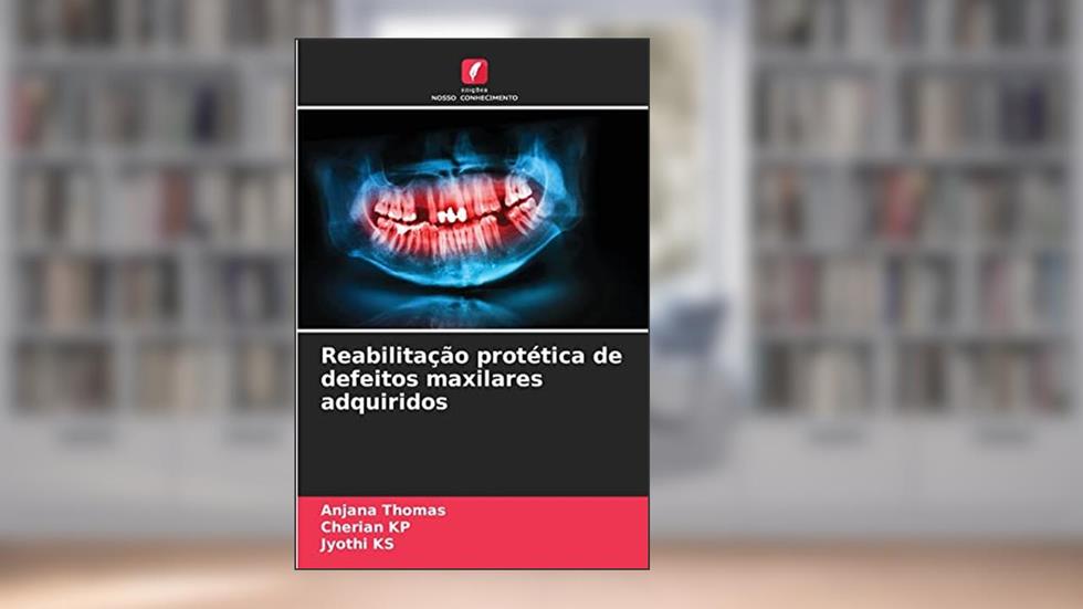 Reabilitação protética de defeitos maxilares adquiridos, do autor Anjana Thomas; Cherian KP; Jyothi KS