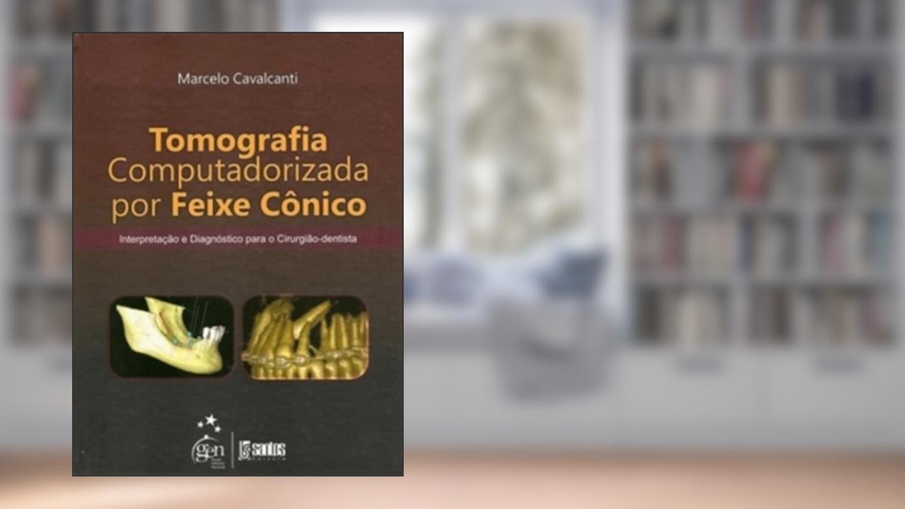 Tomografia Computadorizada por Feixe Cônico - Interpretação e Diagnóstico para o Cirurgião-Dentista, do autor Marcelo Cavalcanti