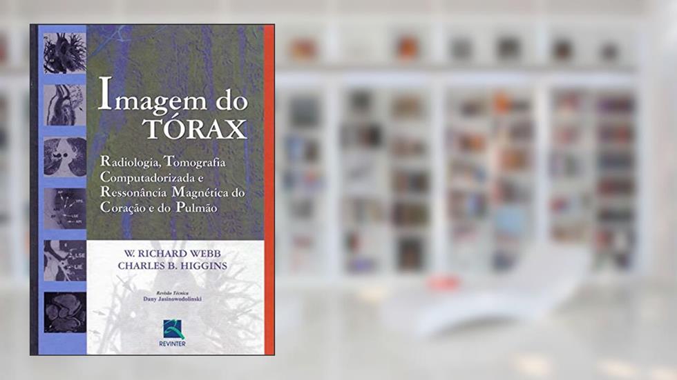 Imagem do Tórax: Radiologia, Tomografia Computadorizada, e Ressonância Magnética do Coração e do Pulmão, do autor W. Richard Webb; Charles B. Higgins