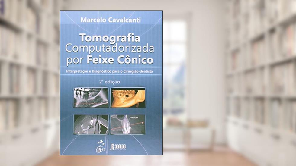 Tomografia Computadorizada por Feixe Cônico - Interpretação e Diagnóstico para o Cirurgião-Dentista, do autor Cavalcanti