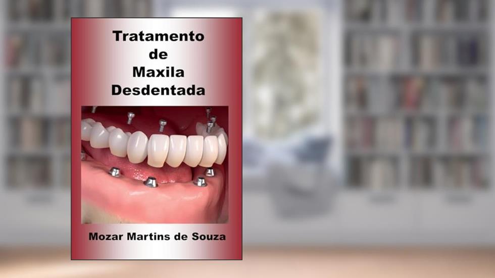 Tratamento de Maxila Desdentada: Implantologia, do autor Mozar M de Souza