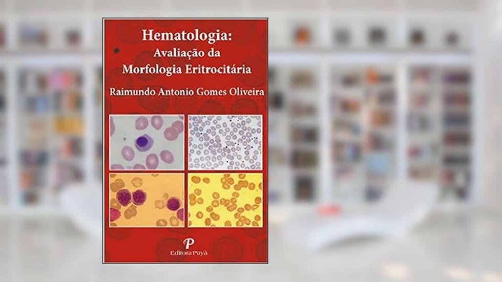 Hematologia: Avaliação da Morfologia Eritrocitária, do autor Raimundo Antonio Gomes Oliveira