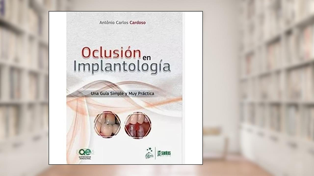 Oclusión en Implantología - Una Guía Simple y muy Práctica, do autor Antonio Carlos Cardoso