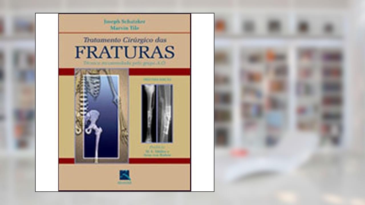 Tratamento Cirurgico Das Fraturas - 02ed/02, do autor Schatzker, Joseph E Tile, Marvin