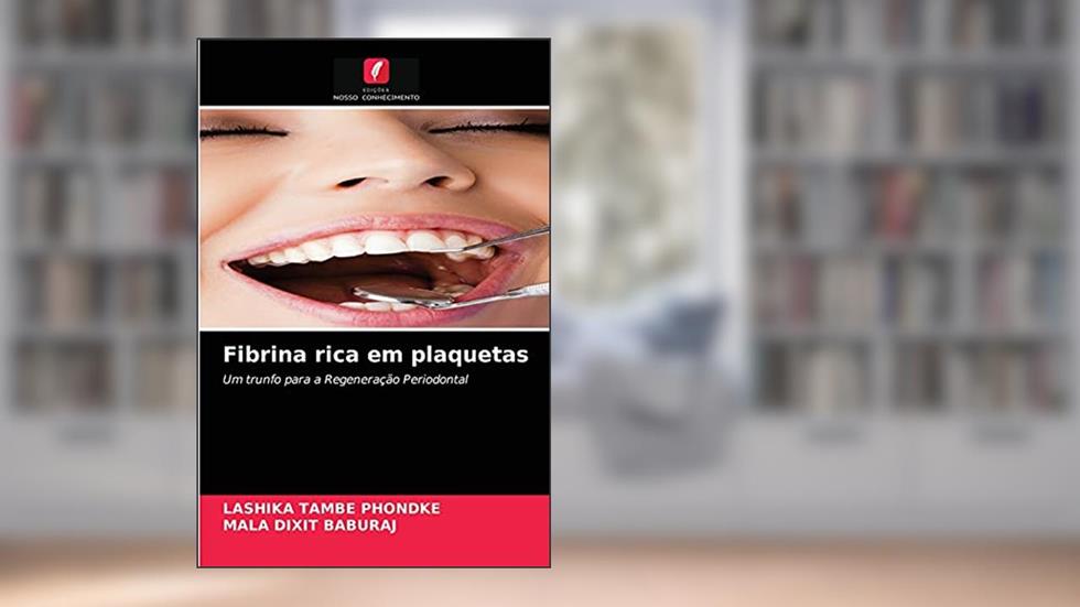 Fibrina rica em plaquetas: Um trunfo para a Regeneração Periodontal, do autor LASHIKA TAMBE PHONDKE; MALA DIXIT BABURAJ