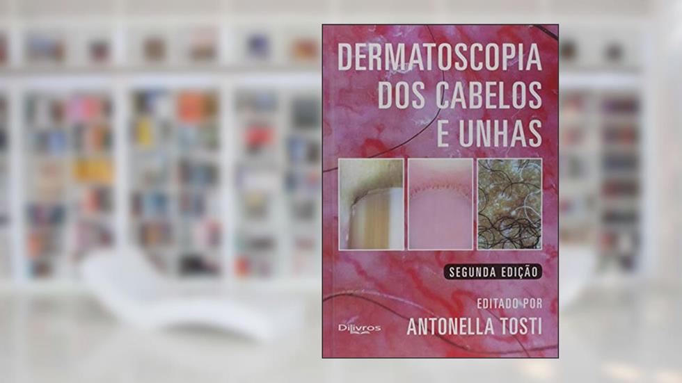 Dermatoscopia dos Cabelos e Unhas, do autor Antonella Tosti
