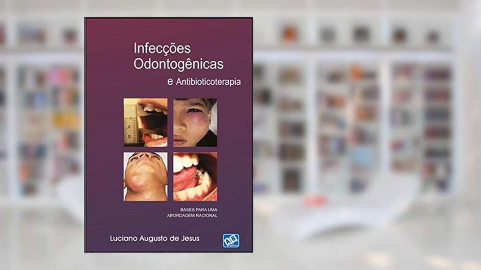 Infecções Odontogênicas e Antibioticoterapia, do autor Luciano Augusto de Jesus