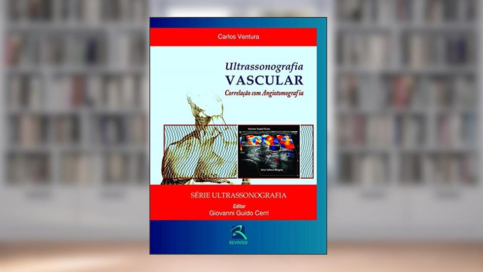 Ultrassonografia Vascular: Correlação com Angiotomografia, do autor Giovanni Guido Cerri; Carlos Ventura