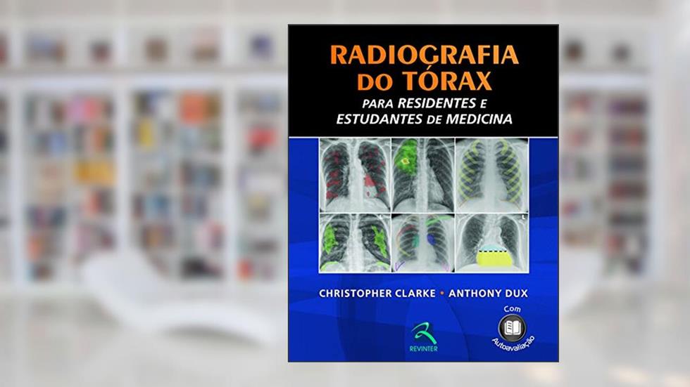 Radiografia do Tórax, do autor Christopher Clarke