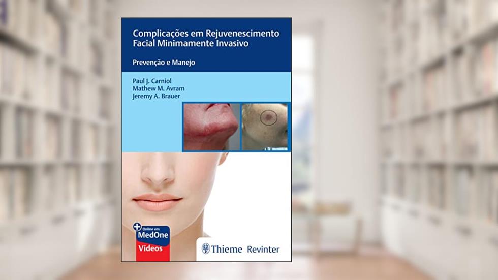 Complicações em Rejuvenescimento Facial Minimamente Invasivo: Prevenção e Manejo, do autor Paul J. Carniol; Mathew M. Avram; Jeremy A. Brauer