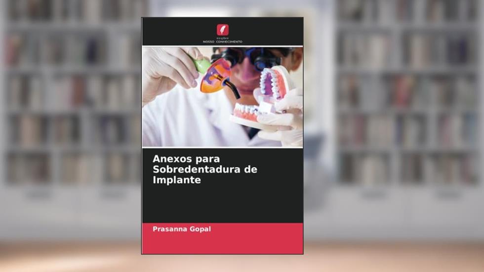 Anexos para Sobredentadura de Implante, do autor Prasanna Gopal
