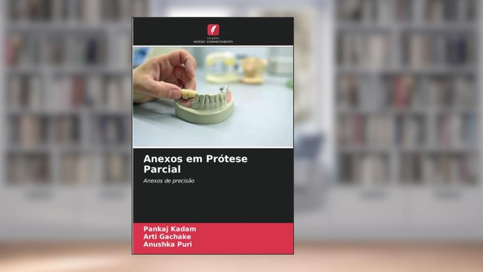 Anexos em Prótese Parcial: Anexos de precisão, do autor Pankaj Kadam; Arti Gachake; Anushka Puri