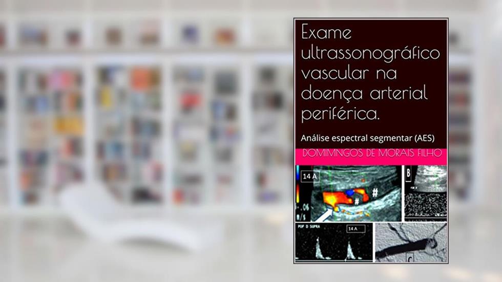 Exame ultrassonográfico vascular na doença arterial periférica.: Análise espectral segmentar (AES), do autor Domingos de Morais Filho