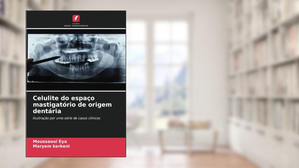 Celulite do espaço mastigatório de origem dentária: Ilustração por uma série de casos clínicos, do autor Moussaoui Eya; Maryem Kerkeni