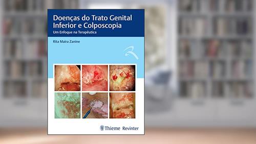 Capa de Doenças do Trato Genital Inferior e Colposcopia: Um Enfoque na Terapêutica, do autor Rita Maira Zanine