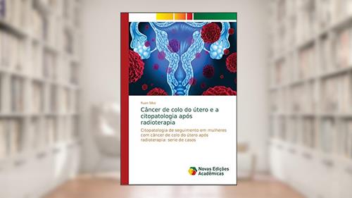 Capa de Câncer de colo do útero e a citopatologia após radioterapia: Citopatologia de seguimento em mulheres com câncer de colo do útero após radioterapia: serie de casos, do autor Ruan Silva
