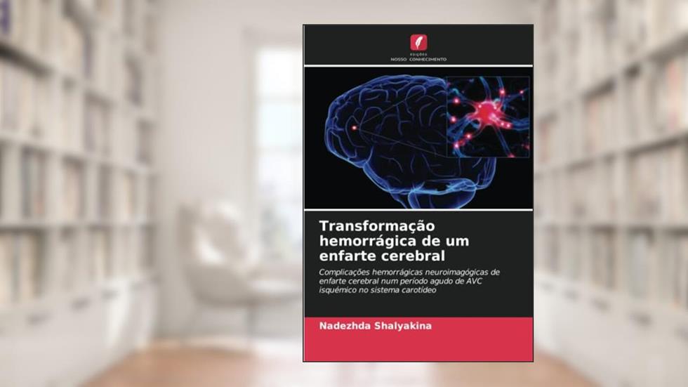 Transformação hemorrágica de um enfarte cerebral: Complicações hemorrágicas neuroimagógicas de enfarte cerebral num período agudo de AVC isquémico no sistema carotídeo, do autor Nadezhda Shalyakina