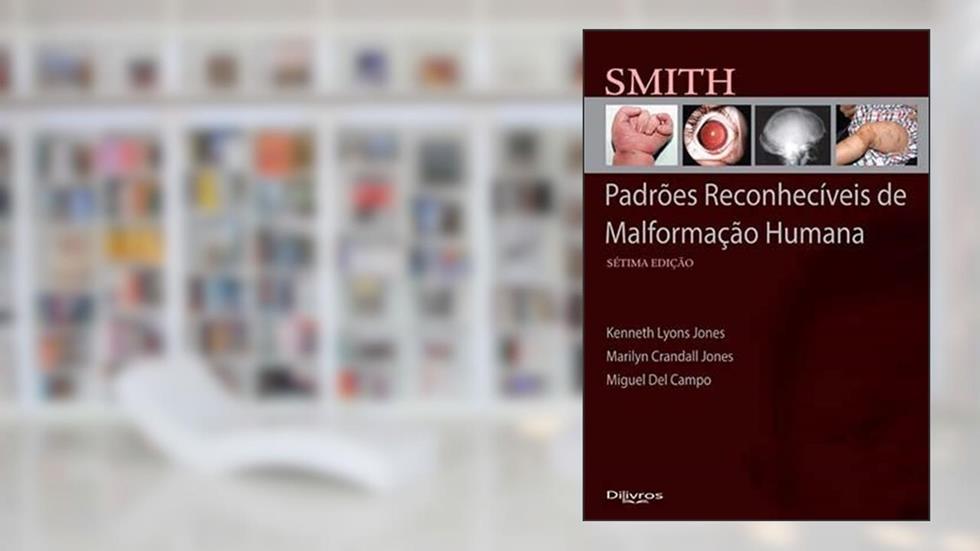 SMITH PADROES RECONHECIVEIS DE MALFORMACAO HUMANA, do autor KENNETH LYONS JONES MARILY CRANDALL JONES MIGUEL DEL CAMPO