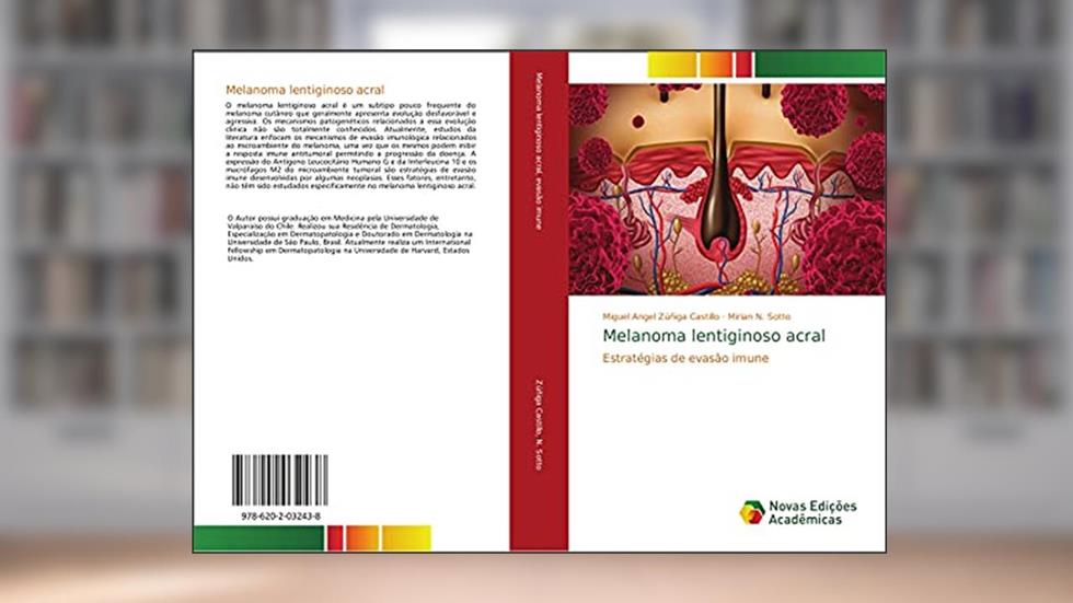 Melanoma lentiginoso acral: Estrate¿gias de evasa¿o imune, do autor Miguel Angel Zúñiga Castillo; Mirian N. Sotto